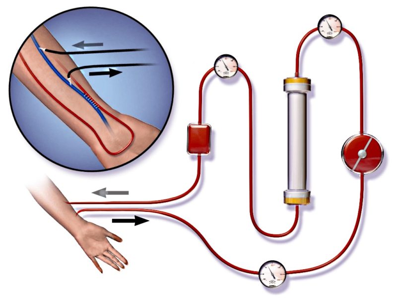 Figure 9